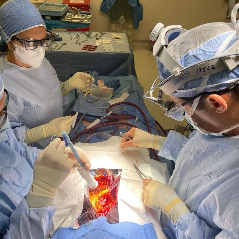 El cirujano cardiovascular Juan Hernández junto a su equipo médico en el Centro Cardiovascular de Puerto Rico durante la cirugía para conectar el conducto Konect-Resilia.