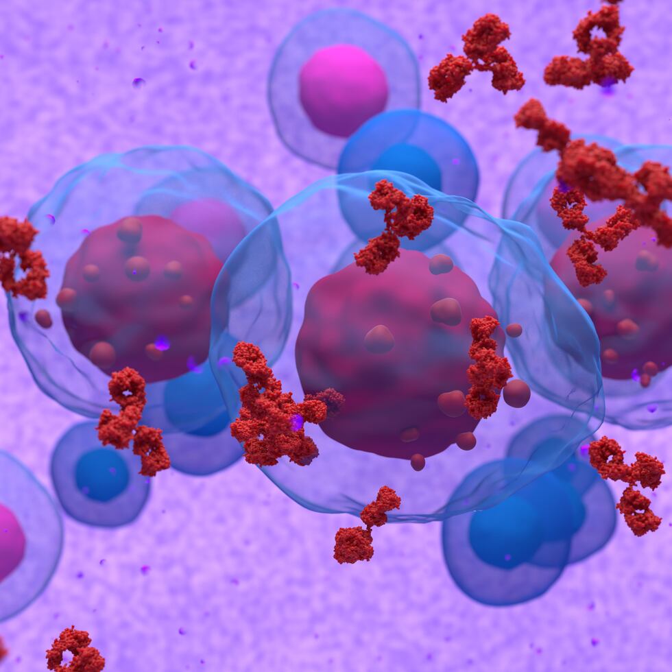 Con un diagnóstico de mieloma múltiple, las células plasmáticas malignas invaden el espacio de la médula ósea, causando que pierda su capacidad para producir células sanguíneas.