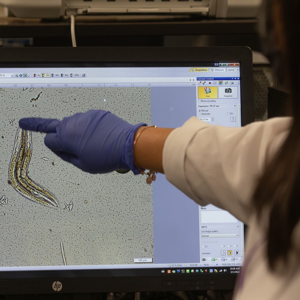 La estudiante Darielys Maldonado muestra en pantalla tres gusanos (uno al lado del otro) en el laboratorio, en la Universidad Católica en Ponce.