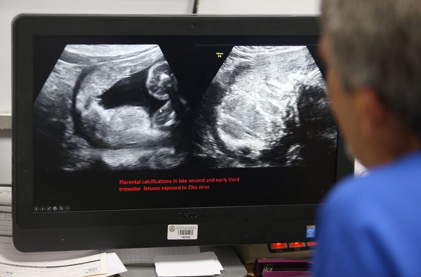 El doctor Alberto de la Vega, director de la Unidad de Evaluación Prenatal del Hospital Universitario.