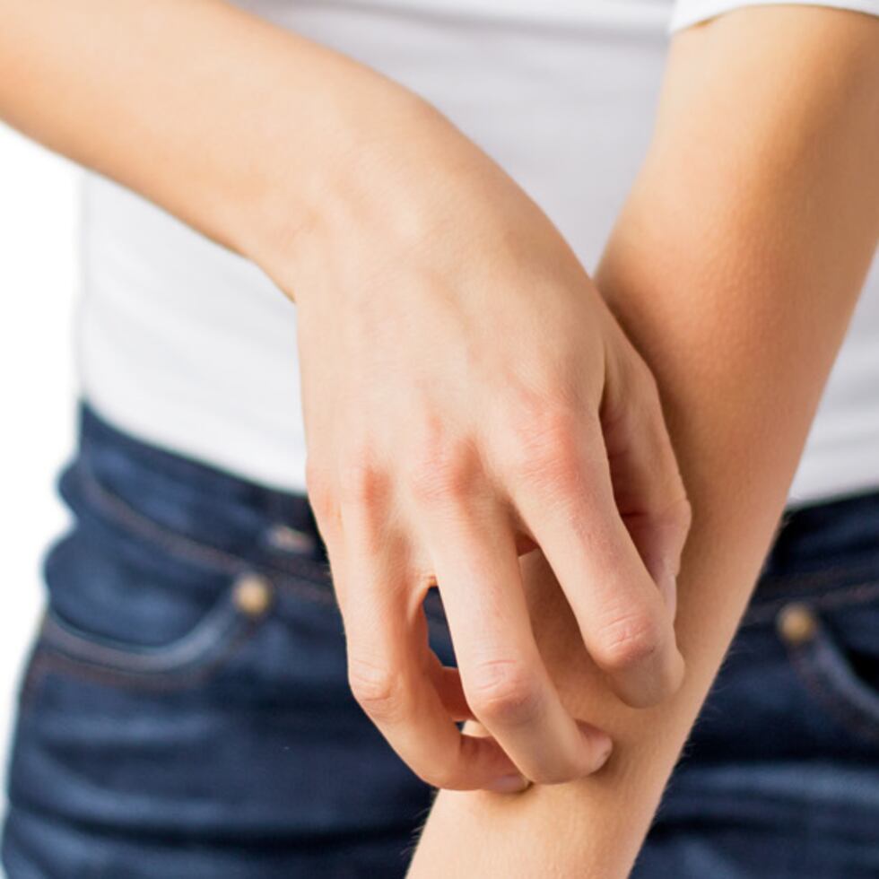 La piel es la primera línea de defensa contra los estímulos externos. (Shutterstock)