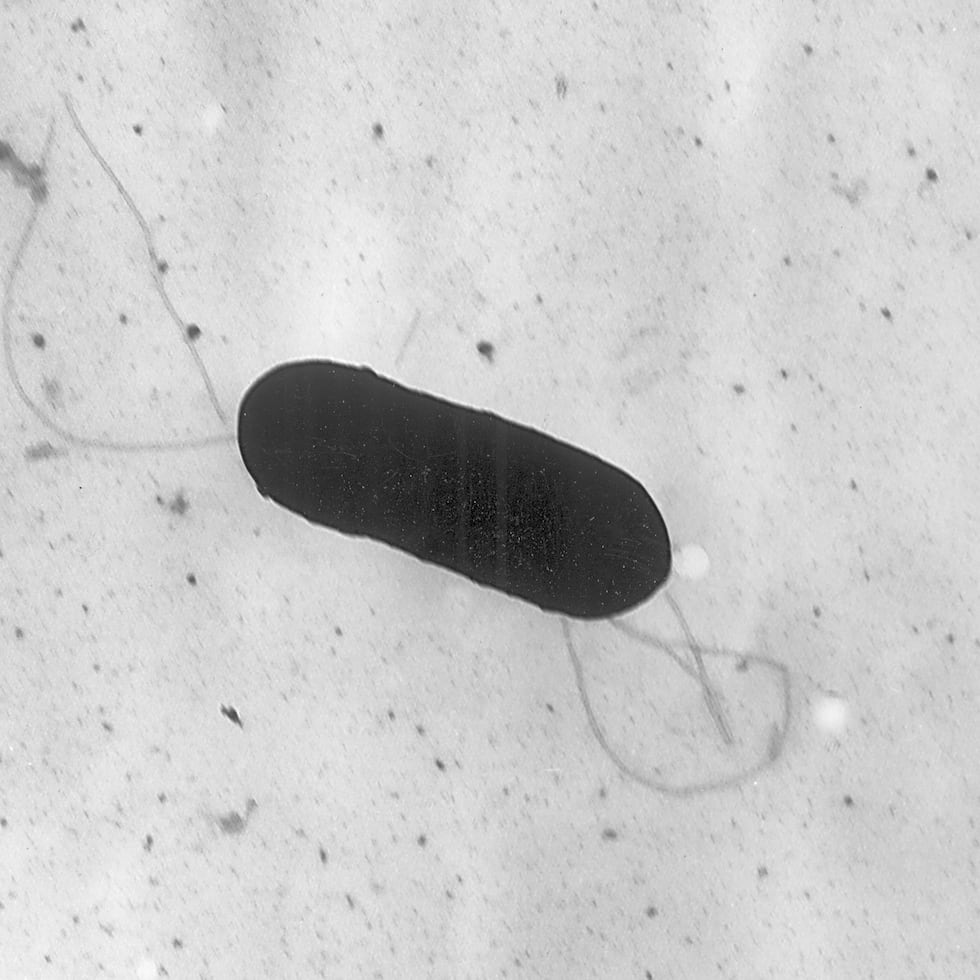 Esta imagen tomada con un microscopio electrónico y facilitada por los Centros para el Control y la Prevención de Enfermedades muestra una bacteria Listeria monocytogenes que causa la listeriosis.