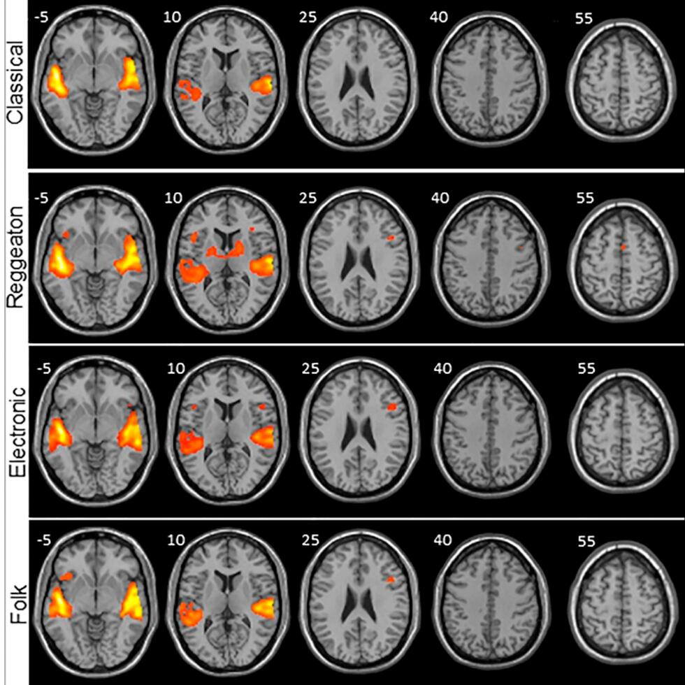 Frente a la música clásica, el folclore y la electrónica, el reguetón provoca una mayor activación en las regiones del cerebro encargadas de procesar no sólo los sonidos, sino también el movimiento, según un estudio llevado a cabo por investigadores en Islas Canarias, en España, sobre la actividad cerebral que produce escuchar diferentes estilos musicales.