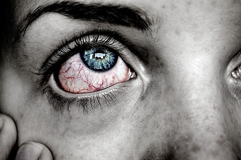 Los ojos rojos son un trastorno en el que la parte blanca (llamada esclera) toma ese color debido a la ruptura o la dilatación de los vasos sanguíneos. (agnesliinnea / Pixabay)