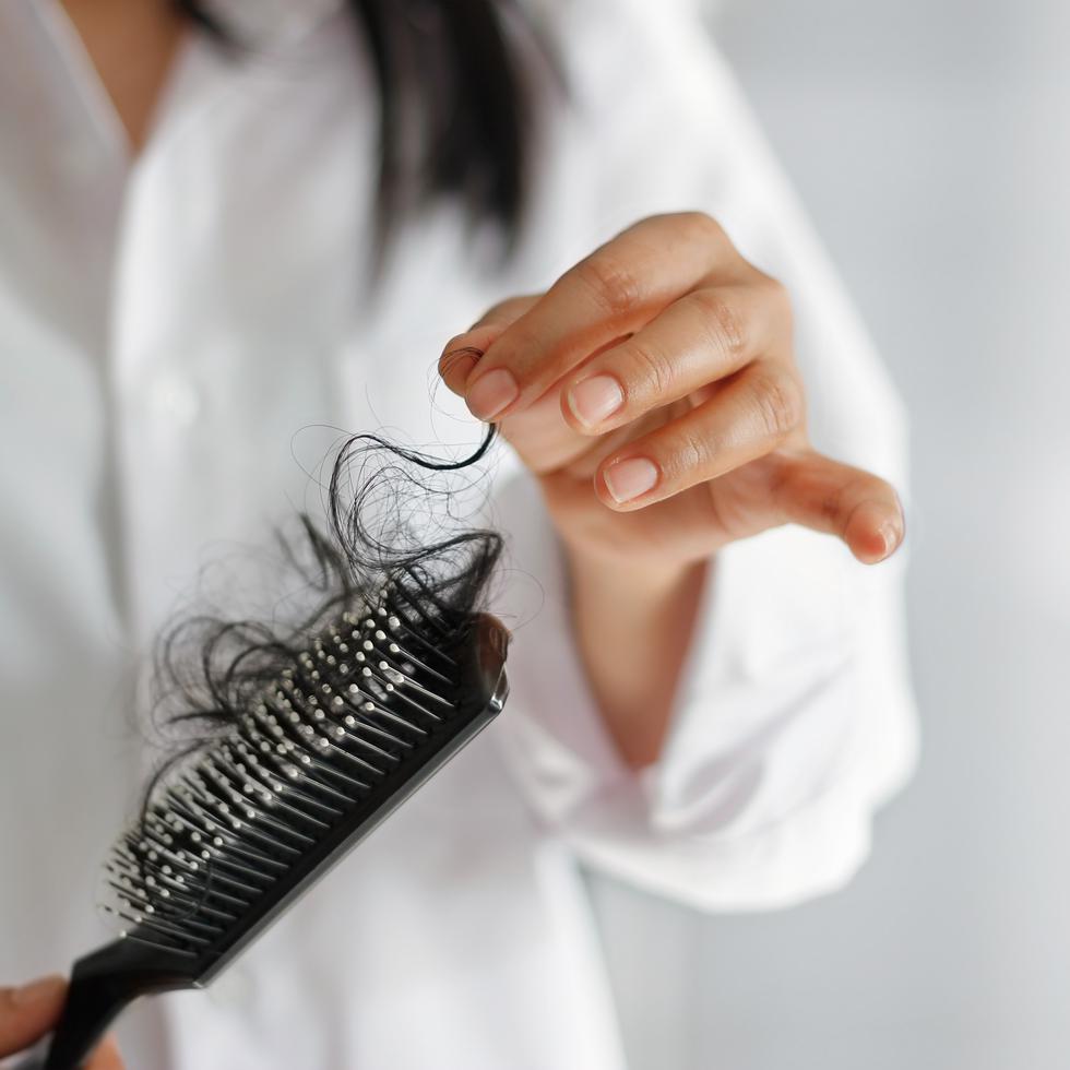 La caída de cabello puede deberse a los alimentos que se consumen.