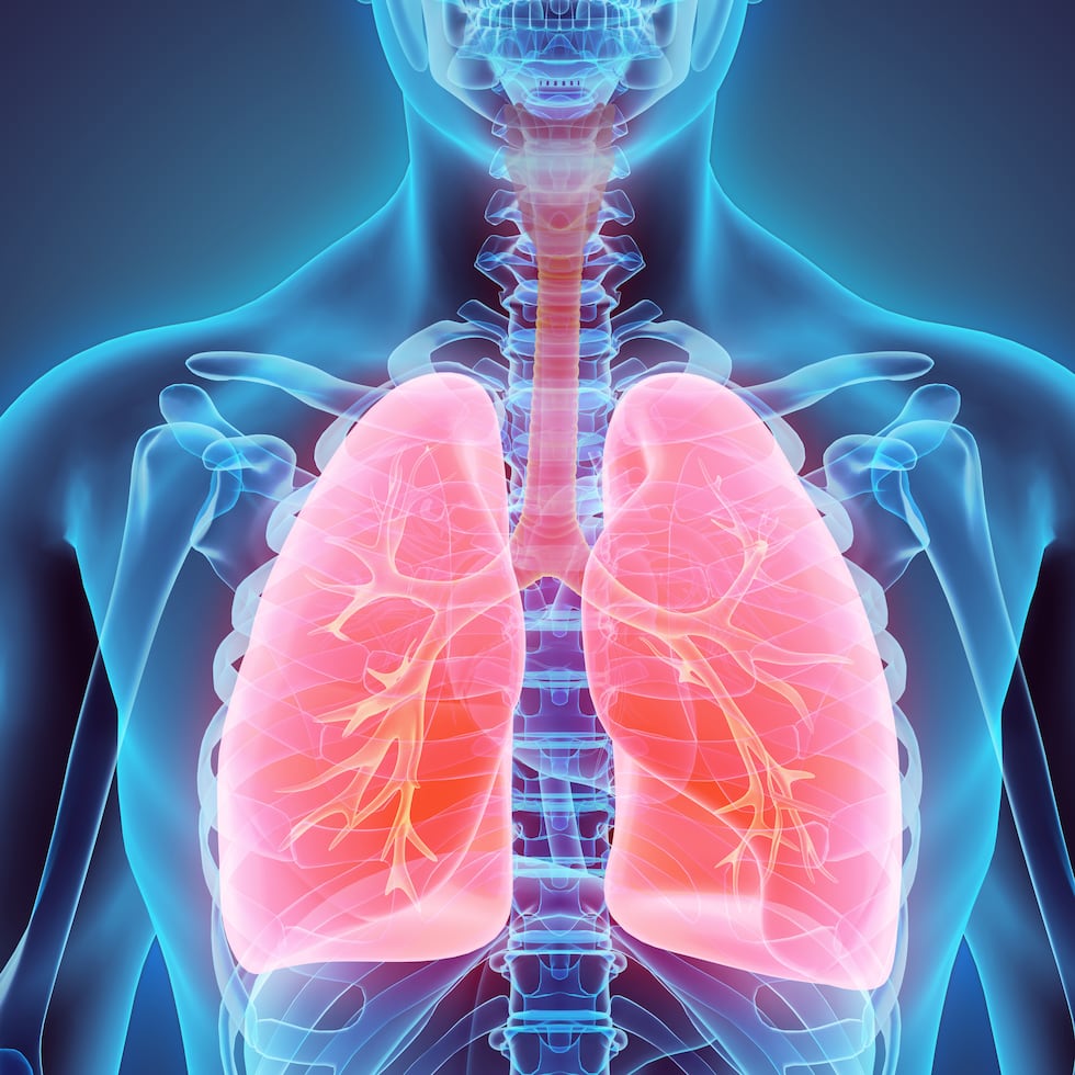 El cáncer de pulmón se origina en el mismo órgano y, a diferencia de otros tipos de cáncer, puede diseminarse a otros órganos como el cerebro y los ganglios linfáticos, con bastante rapidez.
