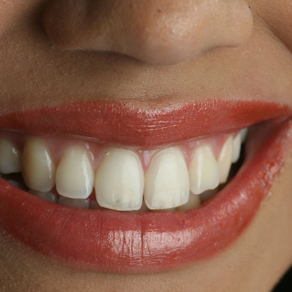 Las pastas de dientes con flúor fortalecen los dientes y también eliminan las bacterias