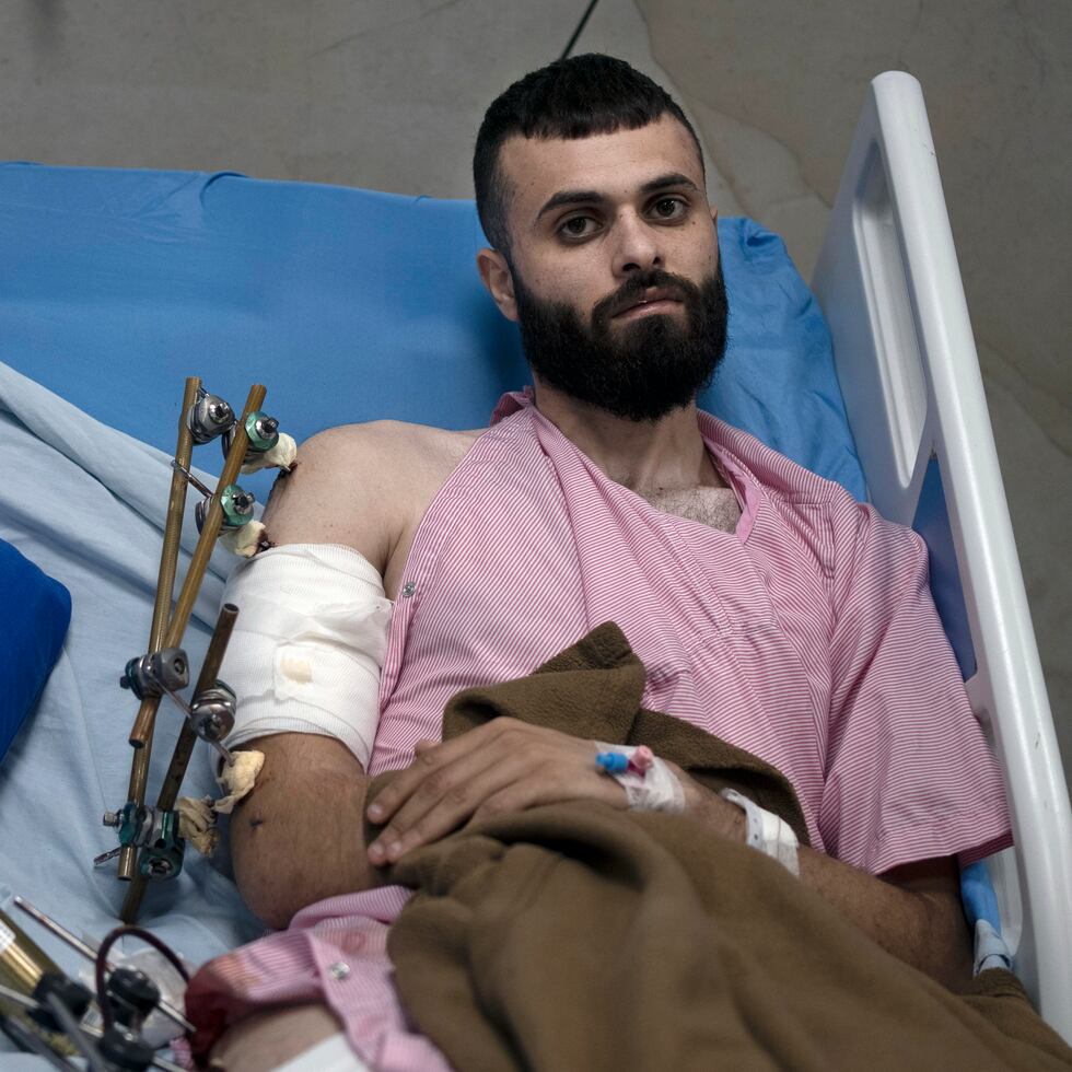 Mujahid Abadi, de 24 años, posa para una foto en el Hospital Especializado Ibn Sina, donde se recupera de heridas de bala y quemaduras, en la ciudad de Jenin, Cisjordania.