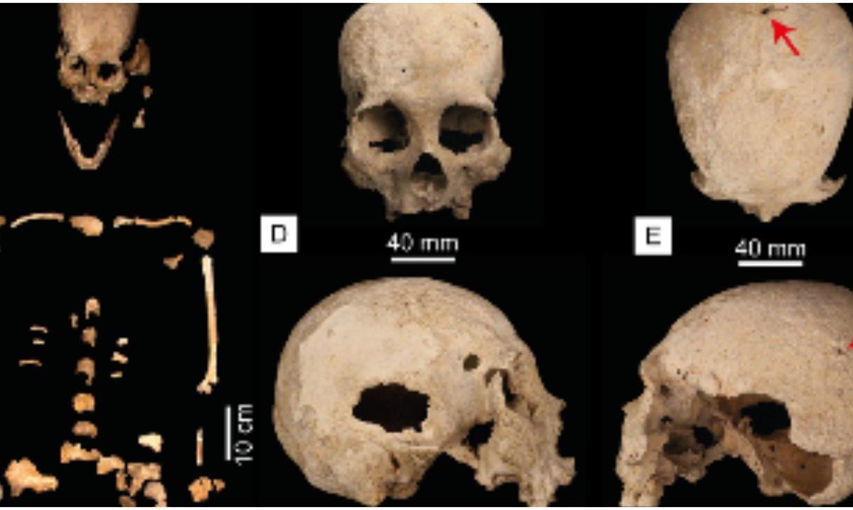 Encuentran El Esqueleto De Una Mujer Que Vivió Hace 9900 Años El Nuevo Día 0175